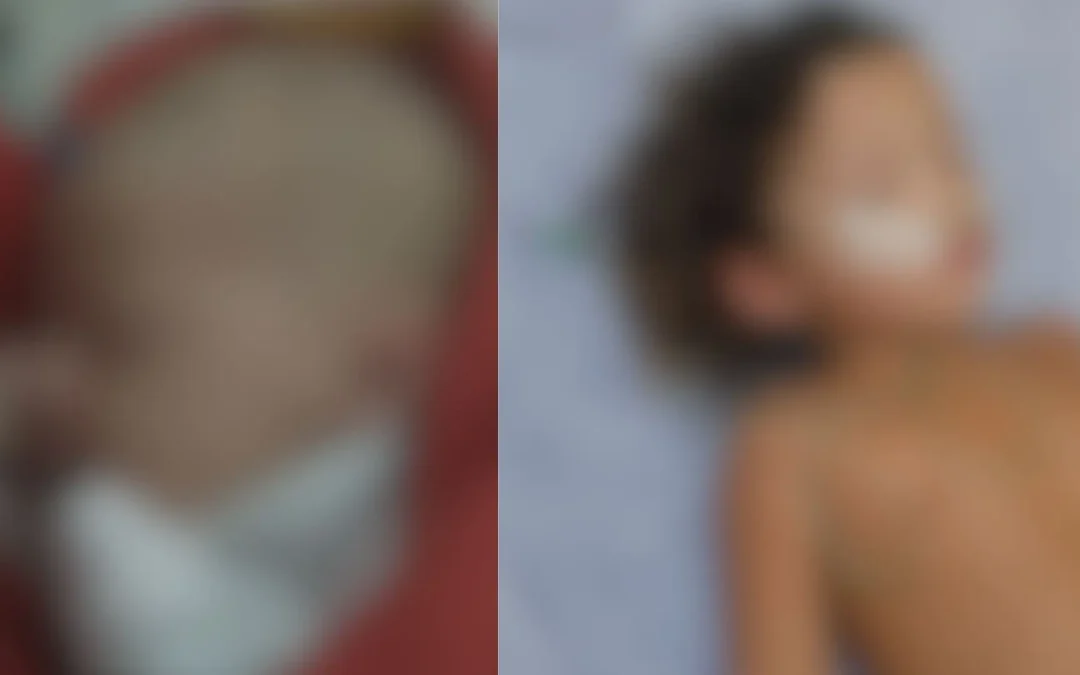 Com caos na saúde, Campo Grande não abre novos leitos e tem 20 crianças na fila por hospital