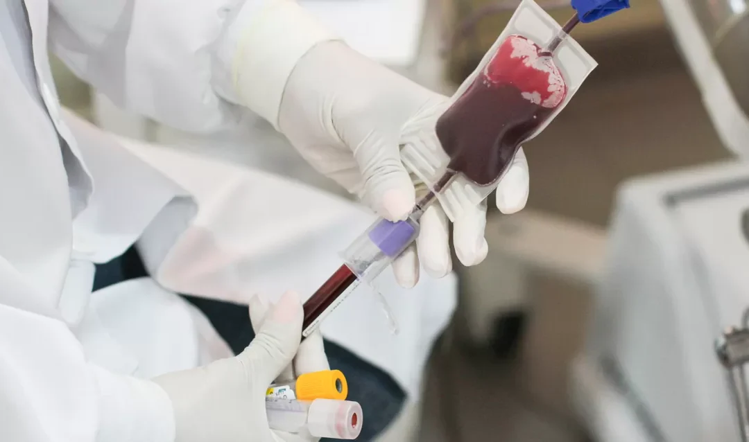 Em 11 meses, mais de 300 pessoas foram diagnosticadas com HIV na Capital